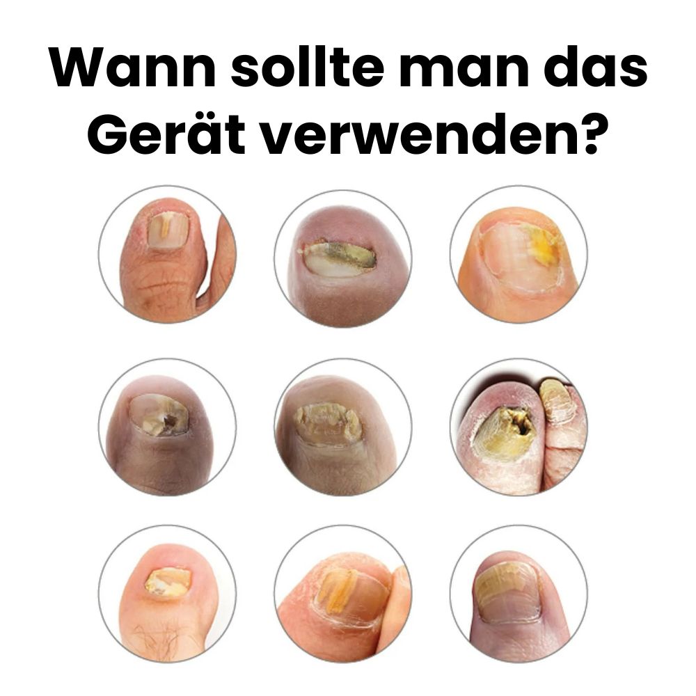 OrthoVital Anti-Pilz-Gerät