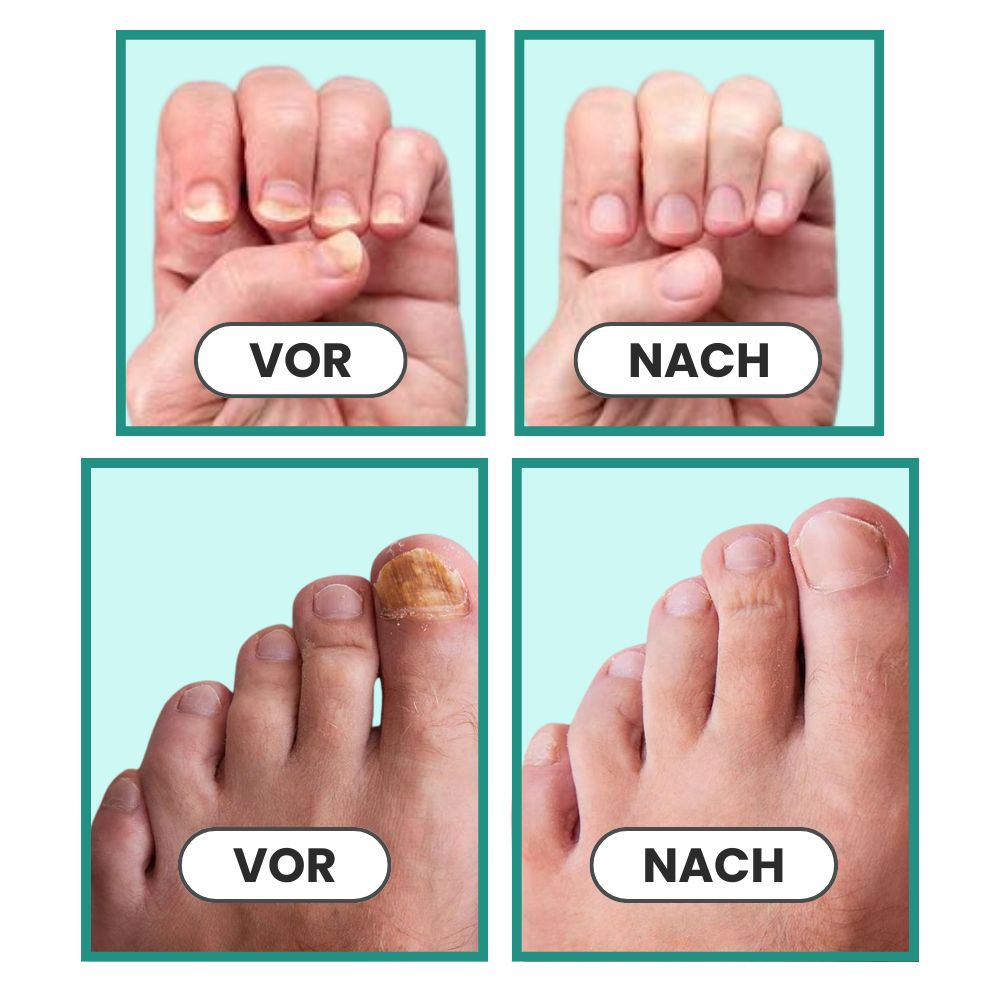 OrthoVital Anti-Pilz-Gerät